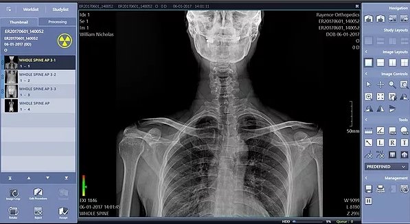 Digital Portable X-Ray - Lead Glass Pro